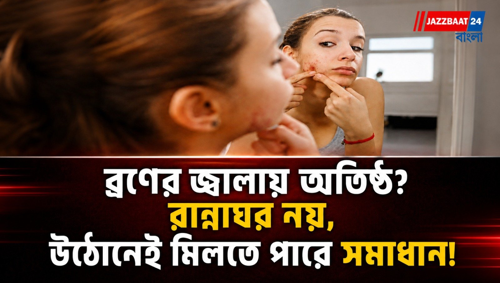 ব্রণের জ্বালায় অতিষ্ঠ? রান্নাঘর নয়, উঠোনেই মিলতে পারে সমাধান!
