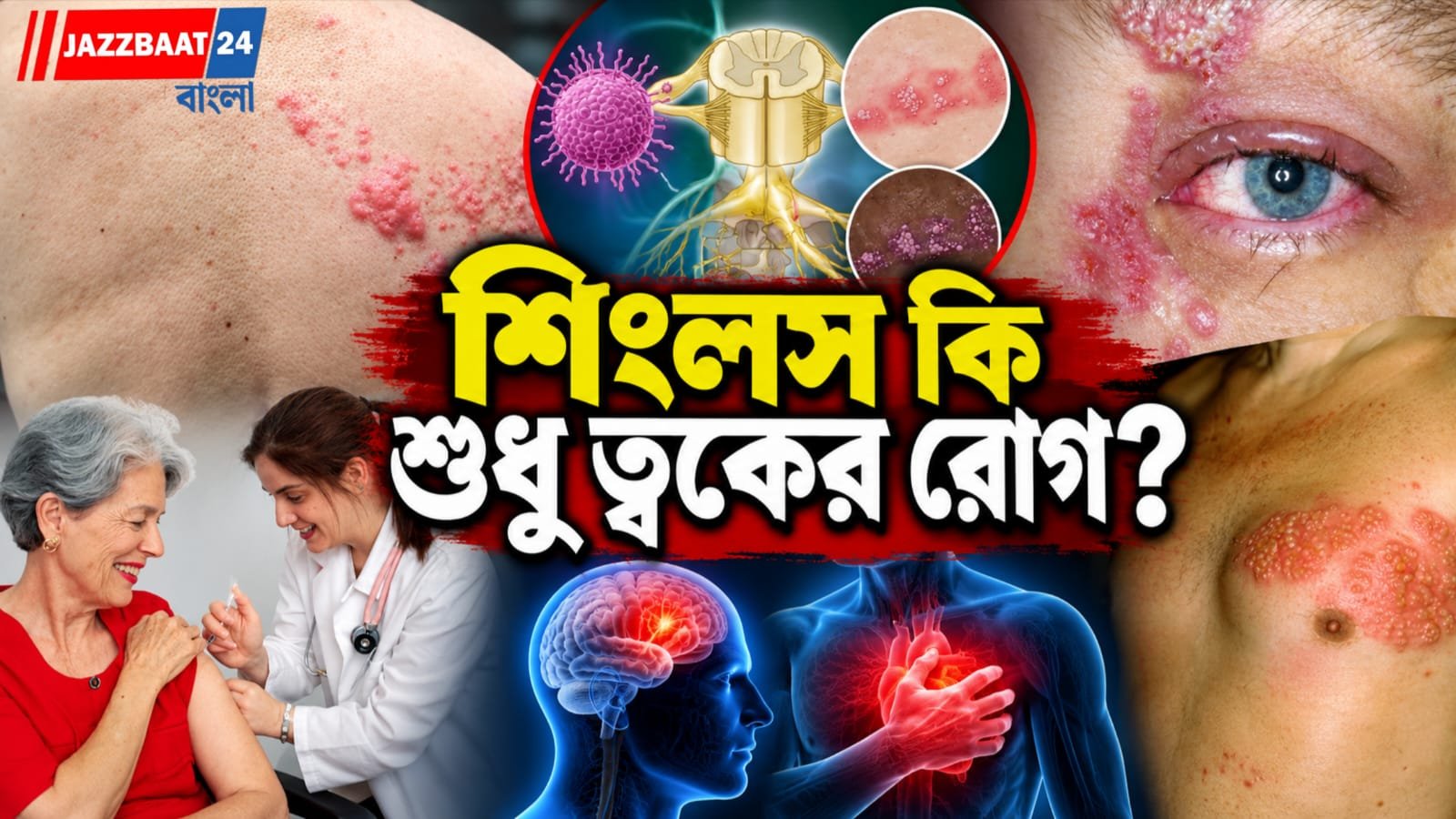 Skin Care: শুধু ত্বকের রোগ ভেবে ভুল করবেন না! শিংলস থেকেই বাড়তে পারে স্ট্রোক-হার্ট অ্যাটাকের ঝুঁকি, সতর্ক করছেন বিশেষজ্ঞরা