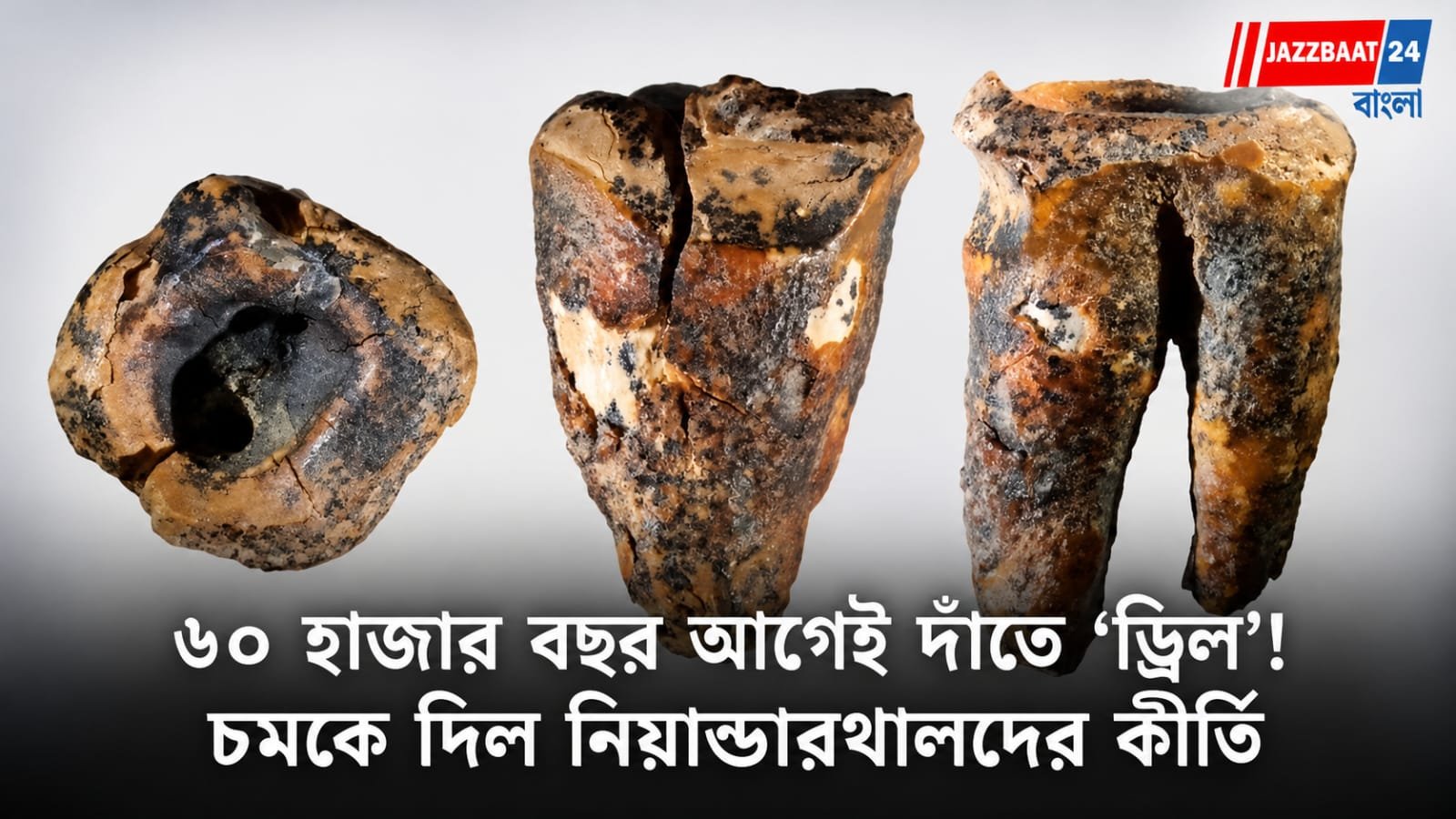 Neanderthal: ৬০ হাজার বছর আগেই দাঁতের অস্ত্রোপচার! নিয়ান্ডারথালদের চিকিৎসার প্রমাণ মিলল গবেষণায়